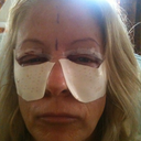 Next day post op, freaking out. First time jitters!