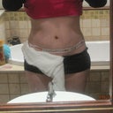 23 Sept post op still swollen......
