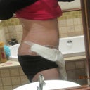 23 Sept post op still swollen 2