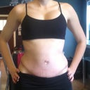 My scar is higher on one side and looks darker in pics than in person.