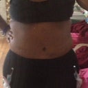1 Week PO, with clothes-- i am in LOVE with the skill of Dr. Linderman and the height of the scar-- magnifique!
