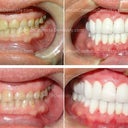 Before and after