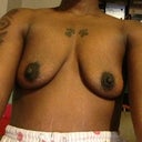 Can't wait to fix these awful saggy deflated boobs