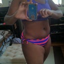 Nov. Almost 6 months Post Op! Still having swelling and numbness under the belly button!