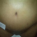 3wks post-up (very swollen)