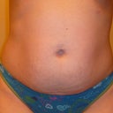 2.5 weeks before sx