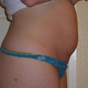 2,5 weeks before sx