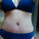 6.5weeks PO: First bikini in 22 years