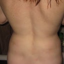 4 weeks post