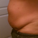 Day before surgery
