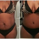 Another before and after photo.  3 Weeks Post Op....I love these before and after pictures.  Amazing!  I'm so glad a did this.  Love Love Love my belly button.