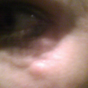 taken aweek ago /have had since march 09