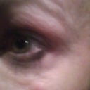 recent pic of so called temp lumps