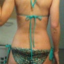 3 1/2 wks after zeltiq treatment to inner thighs