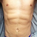 10 weeks post Vaser Lipo.