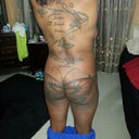 The night before surgery (back)