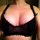 6 weeks post op