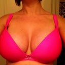 6 weeks post op