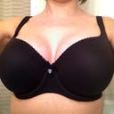 6 weeks post op