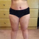 5 weeks post-op (still swollen)