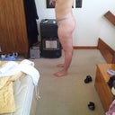 10 days post op side