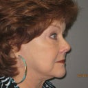 After right side profile Feb 6, 2012