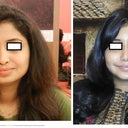 before/after