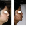 before after profile