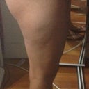 Flat ass as 4 weeks 3 days after bbl :'(