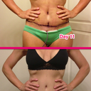 This pic shows how much the scar really does move.  So cool.