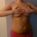 Front day 7