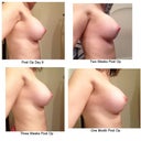 Changes over the 1st month