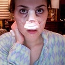 Night of surgery (excuse looking like a mess )