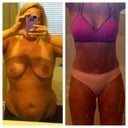 Before and 7 months post op