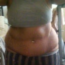 before , hours before surgery