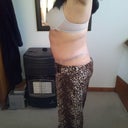 7 days post op side