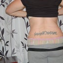 2 wks, swollen all the way around. See my flat bum, got that fixed later...