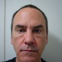 Three Days after procedure.
