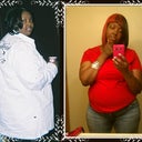 292 VS 230 3 Months post-0p