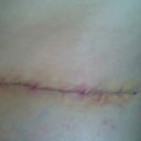 Other side