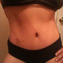 10 Weeks/5 Days Post - You can see the mark that Mr. Blister left.
