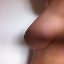 side view