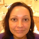 60 Year Old Woman Has Brow Lift
