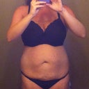 Week before surgery. My panties are below the roll...blah