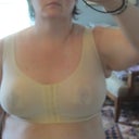 After 3 -- 1 week post op