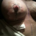 Up close lt boob