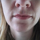 2 month close up.