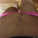 Wanted to show u top view on how swollen I am right now and how my belly button looked. The swollen part where my pooch use to be  is sticking out as you can see , it feels  numb and hard as a rock when I touch it. I wonder if that's my six pack that was hiding underneath my flab ! Wishful thinking , watch it be Seroma fluid with my lucK ! knock on wood!