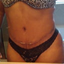 5 weeks PO