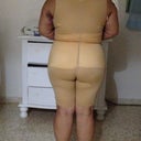 Back view of my sister that had lipo n butt fat transfer